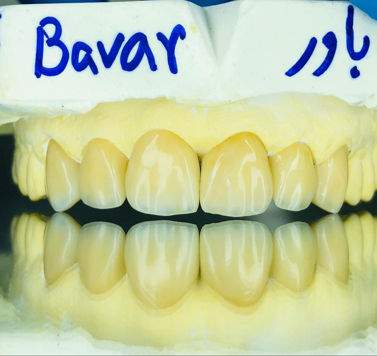 Bavar CAD/CAM Lab